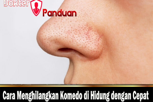 Cara Menghilangkan Komedo di Hidung dengan Cepat