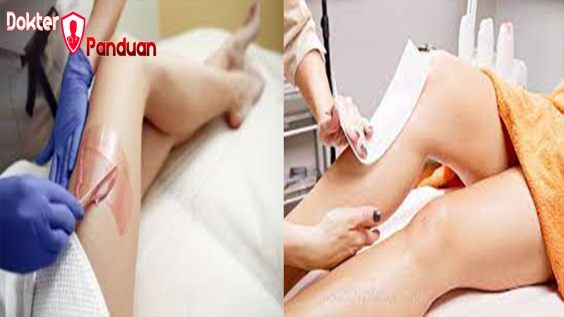 Jenis dan Risiko Bikini Waxing