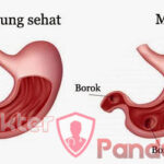 Maag Bukan Takdir! Cegah dan Atasi dengan Gaya Hidup Sehat
