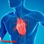 Penyakit Jantung Panduan Mencegah dengan Gaya Hidup Sehat